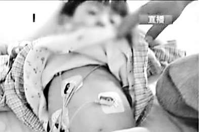 昆明疑被灌汞男童今天做手術(shù) 警方已立案調(diào)查