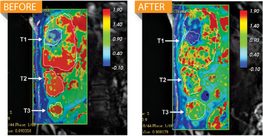 喚醒人體沉睡防御系統 美找到癌癥克星并有望包治百病