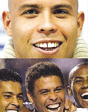 體壇明星整容大揭秘 劉翔整容為對得起觀眾