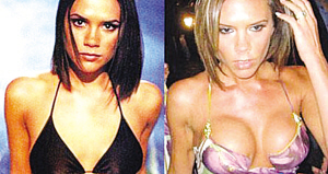 體壇明星整容大揭秘 劉翔整容為對得起觀眾